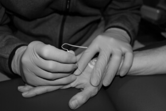 Chiron Diagnostics . . . Providing EMG Testing in Northern Virginia